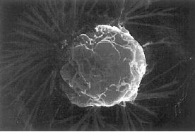 cancer PARA CONSULTAR