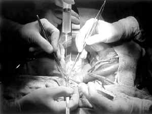 transplante-jpg copia